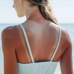 Oparzenia słoneczne — jak je rozpoznać, leczyć i im zapobiegać?