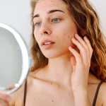 Jaki wpływ mają choroby tarczycy na skórę? Poznaj punkt widzenia kosmetologa