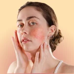 Podrażniona skóra po kwasach/retinolu – jak złagodzić suchą skórę po kuracjach złuszczających?