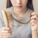Łysienie androgenowe co to jest? Poznaj przyczyny i objawy