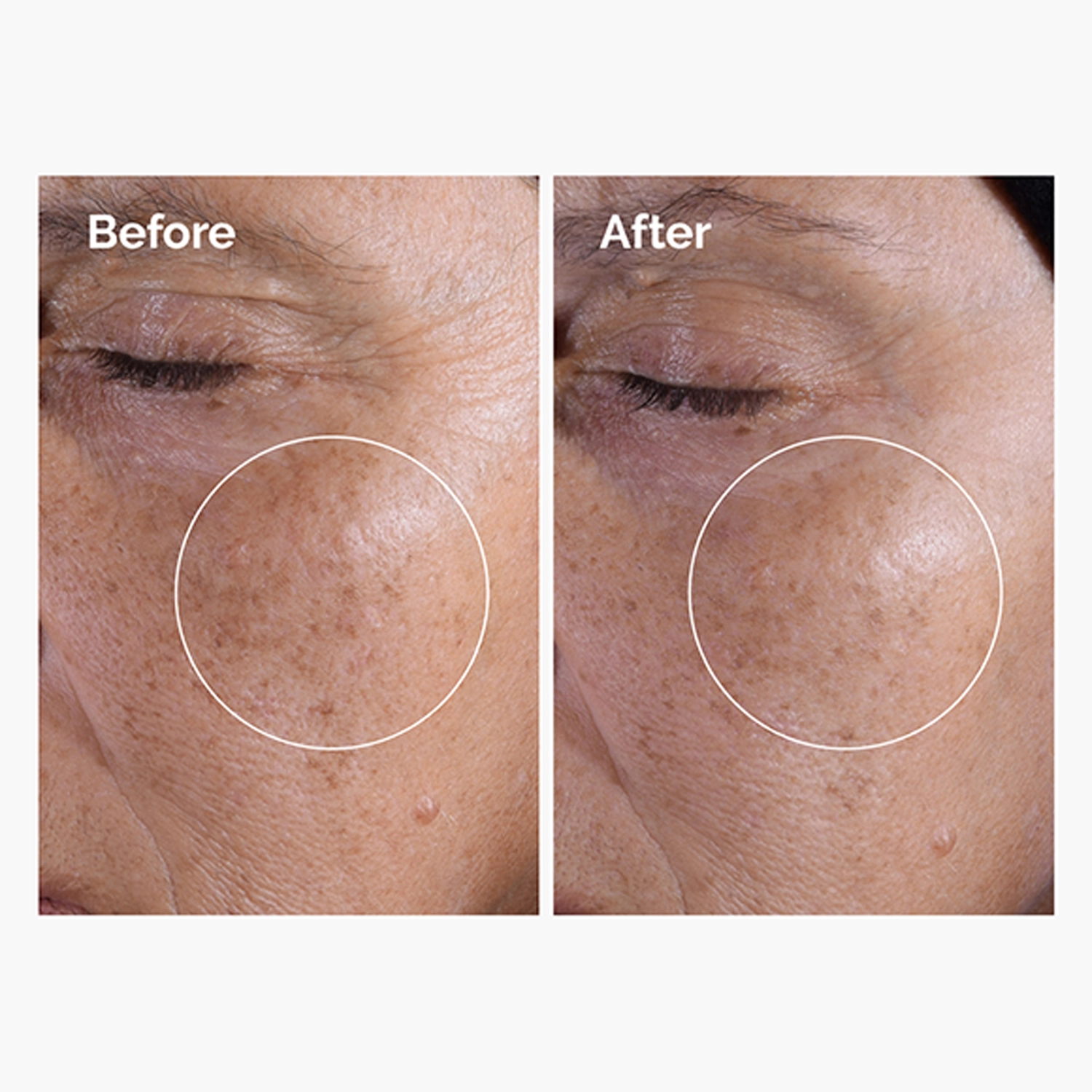The Ordinary - Glycolic Acid 7% Exfoliating Toner - Tonik Peelingujący z 7% Kwasem Glikolowym - tonik do cery tłustej