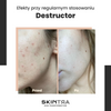 SkinTra - Destructor - Całoroczny Peeling Kwasowy 24% - 30ml