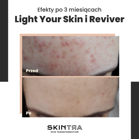 SkinTra - Reviver - Serum Rewitalizujące - 30ml