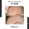 SkinTra - C-Acid - Kwasowa Kuracja z Witaminą C - 30ml