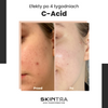 SkinTra - C-Acid - Kwasowa Kuracja z Witaminą C - 30ml