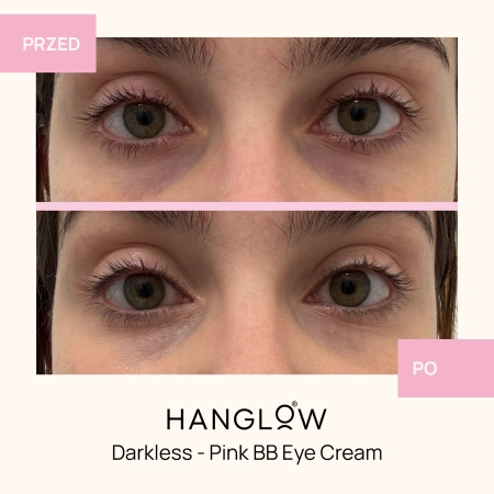HanGlow - Darkless - Pink BB Eye Cream - Krem - Korektor Pod Oczy - 15ml - OUTLET