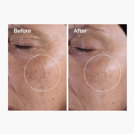 The Ordinary - Glycolic Acid 7% Exfoliating Toner - Tonik Peelingujący z 7% Kwasem Glikolowym - 240ml