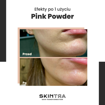 SkinTra - Pink Pow(d)er - Wielofunkcyjny Puder Oczyszczająco-Enzymatyczny Na Bazie Glinki - 40g