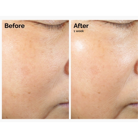 The Ordinary - Rice Lipids + Ectoin Microemulsion - Mikroemulsja z Lipidami Ryżowymi i Ektoiną - 120ml
