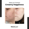 SkinTra - Creamy Happiness - Emulsja z Retinalem 0,1% w Cyklodekstrynach - 30ml