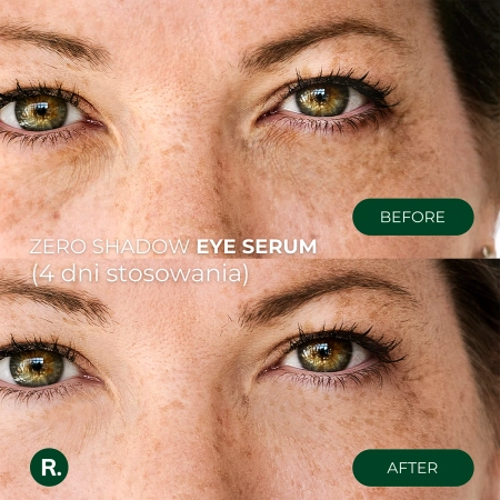 Ralls - Zero Shadow Eye Serum - Serum pod Oczy - 20ml