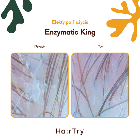 HairTry - Enzymatic King - Trychologiczny Peeling Enzymatyczny z Ficyną - 100ml