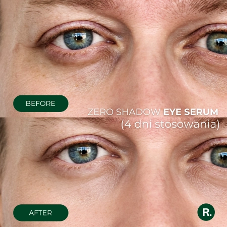 Ralls - Zero Shadow Eye Serum - Serum pod Oczy - 20ml