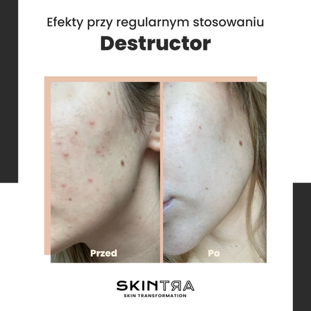 SkinTra - Destructor - Całoroczny Peeling Kwasowy 24% - 100ml