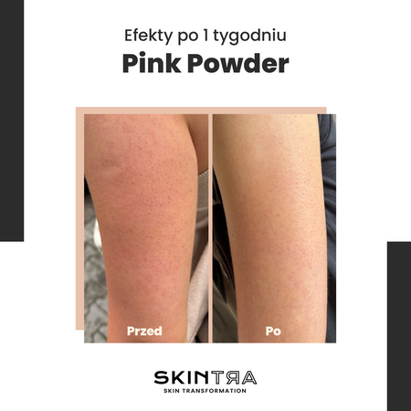 SkinTra - Pink Pow(d)er - Wielofunkcyjny Puder Oczyszczająco-Enzymatyczny Na Bazie Glinki - 40g