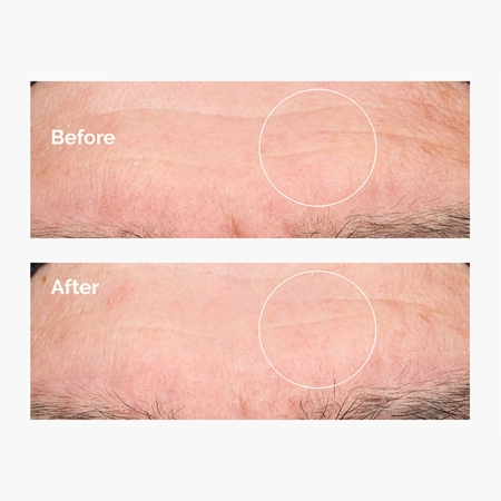 The Ordinary - Hyaluronic Acid 2% + B5 - Serum Nawilżające z Kwasem Hialuronowym 2% i Witaminą B5 - 30ml