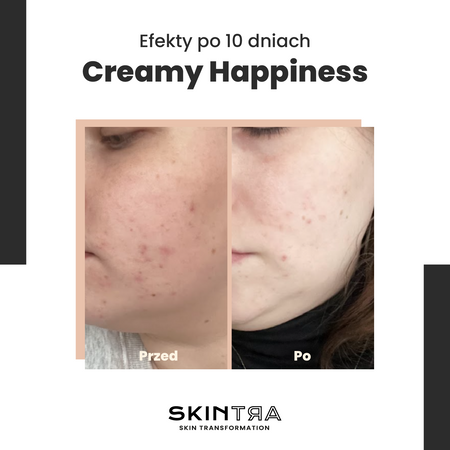 SkinTra - Creamy Happiness - Emulsja z Retinalem 0,1% w Cyklodekstrynach - 30ml