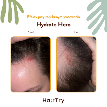 HairTry - Hydrate Hero - Nawilżająco-Kojąca Wcierka do Skóry Głowy z Kompleksem NMF i Ektoiną - 100ml